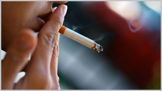 Smoking is a cause of the development of varicose veins