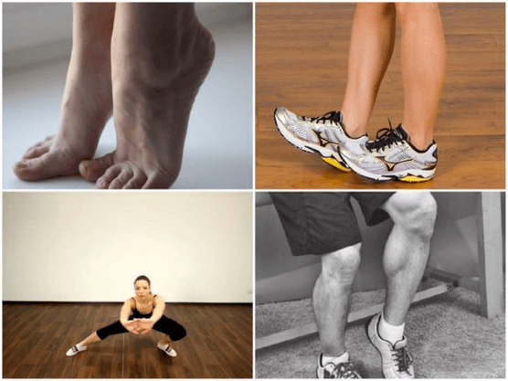 Varicose veins can cause leg pain