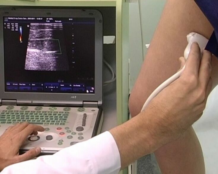 Ultrasonic diagnosis of pelvic varicose
