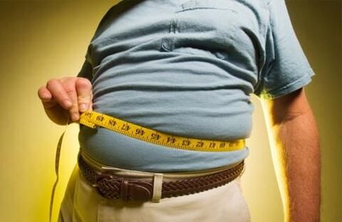 Being overweight can cause varicose veins to develop