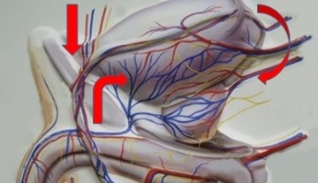 varicose veins the pelvic