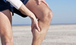 varicose veins on the legs of men