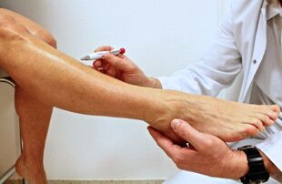 Patients with varicose veins are appointed by a phlebologist